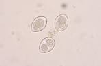 File:Coccidia.JPG - Wikipedia, the free encyclopedia