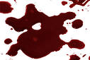 Amazing Collection of Photoshop Blood Splatter Brushes blueblots