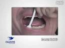 Hiv and Aids Rapid Testing