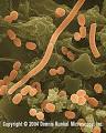 Acinetobacter - MicrobeWiki