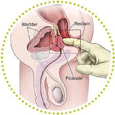 6 Tips to Take Care of Your Prostate