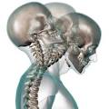 Whiplash | Sports and Spinal Care | Neck Pain | Sports Chiropractor