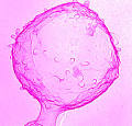 The Rockefeller University » Laboratory of Bacterial Pathogenesis ...