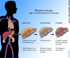 How to Reverse Liver Damage Caused by Alcohol