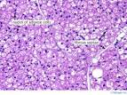 adipose_tissue_brown_40x.jpg