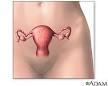 <b>Premature Ovarian Failure</b>: