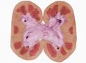 Discovery Health "Is there a link between heart disease and kidney ...