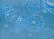 Bacterial vaginosis - Wikipedia, the free encyclopedia