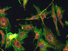 fluorescence <b>microscopy</b> image