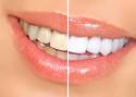 Services | South Dental