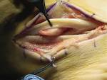 <b>Tendon Injury</b> The Cause?