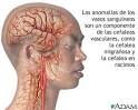<b>Cefalalgia Autónoma Del</b>