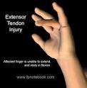 <b>Injuries</b>. DIP Flexor <b>Tendon</b>