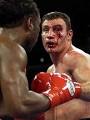 EPIX Vitali KLITSCHKO Conference Call Transcript | Fight Network
