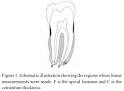 the <b>periapical</b> foramen of