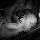 Nuclear and Radiation Disaster