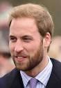 Hairstyles for Balding Men