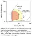 CV Physiology: Diastolic Dysfunction