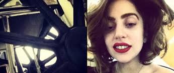 Estrelando - Lady Gaga est&aacute; andando de cadeira de rodas, entenda!