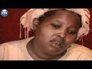 2:35. Blind mother struggles to raise family