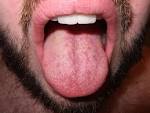 <b>Tongue</b>