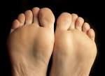 without foot pain or PTTD.