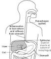 Acid Reflux and Oesophagitis | Health | Patient UK
