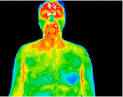 <b>focal</b> tooth <b>infection dental</b>