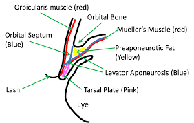 specific type