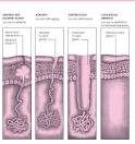 Opiniones de Anhidrosis