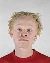 ALBINO africans - Sharenator.