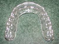 Image result for clear retainer