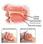 resto del <b>paladar blando</b>,
