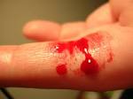 File:Bleeding finger.jpg - Wikipedia, the free encyclopedia