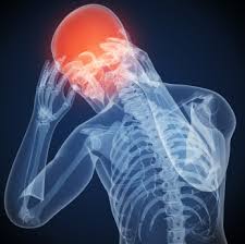 Migraine Headaches..