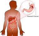 Of The <b>Stomach</b> | Medindia