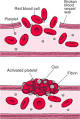 How Blood Clots: Bleeding and Clotting Disorders: Merck Manual ...