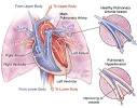 Pulmonary Hypertension, January 23, 2008, Zeller et al. 299 (3 ...