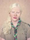 Stunning Portraits of ALBINOs by Gustavo Lacerda