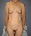 http://t3.gstatic.com/images?q=tbn:ANd9GcTBHwO4IS--aJWOBPlel4VFrjKQ1w0lEBmtKfPzKok8uOPj6nSwqsUqEwLe