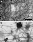 File:Electron <b>microscopy</b>
