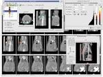AMIDE: a Medical Image Data Analysis Tool