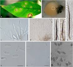 Image result for Colletotrichum heveae