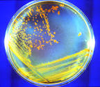 Meet Conan the Bacterium - NASA Science