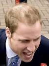 http://wtfman.net/wp-content/uploads/2011/04/prince-william-balding.jpg
