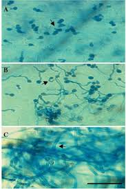 external image images?q=tbn:ANd9GcTD57zfp2UFhdRhDI1P68zi7GDfDr3cd5_9Qlh88U4dkB74B5b0QA