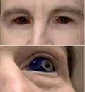 Tattooing is Their Life: Eyeball Tattooing : Peak of Madness