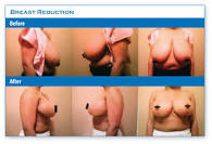 http://t3.gstatic.com/images?q=tbn:ANd9GcTDmPas_jQR2bkqNs62MV034-MJSvY72QqeUn5dzc8CCVmFSlJOphaCCB2r