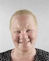 Albino africans - Sharenator.
