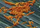 It's Not Easy Having C. DIFFICILE | Nutrivize